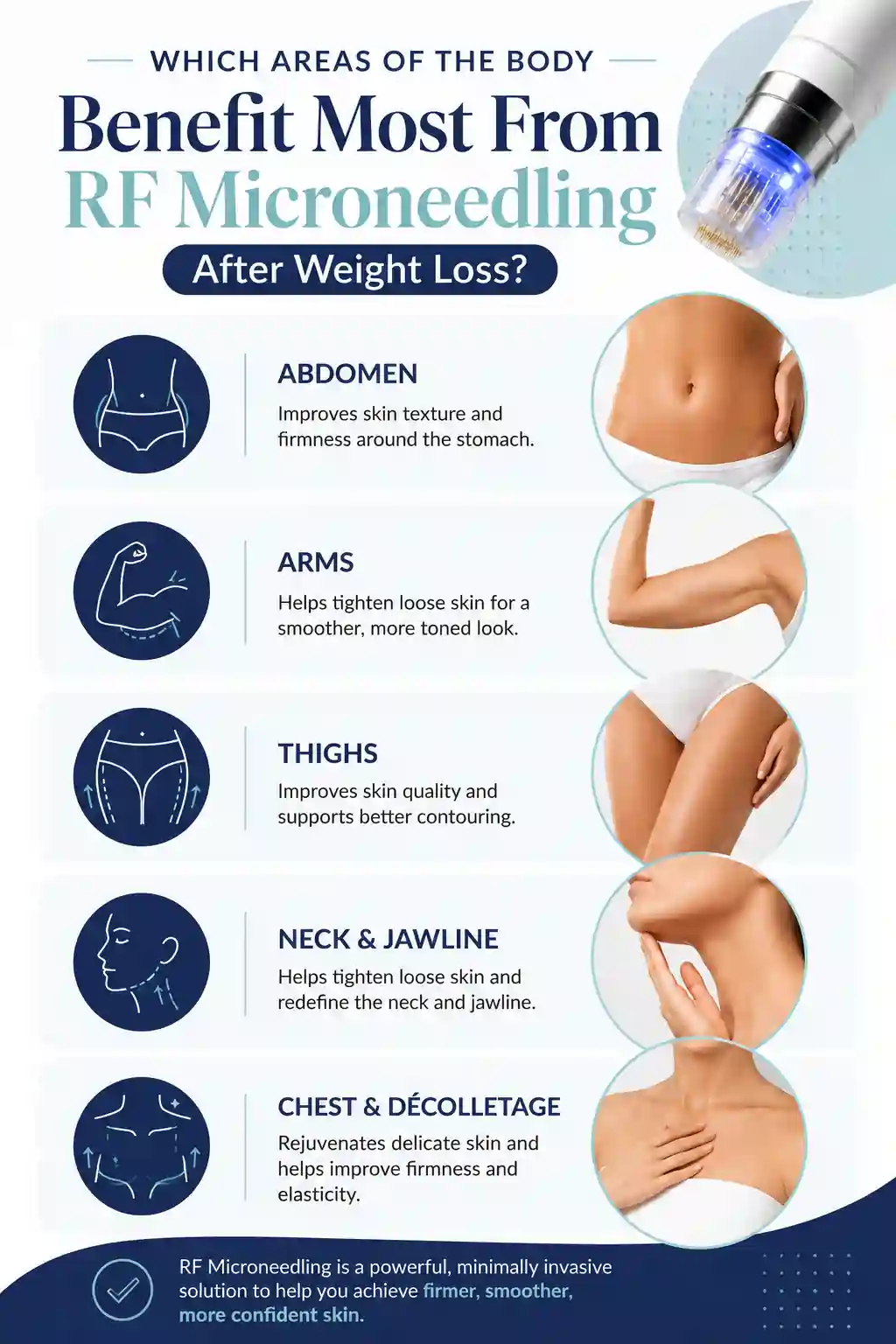 Which Areas of the Body Benefit Most From RF Microneedling After Weight Loss Broxburn